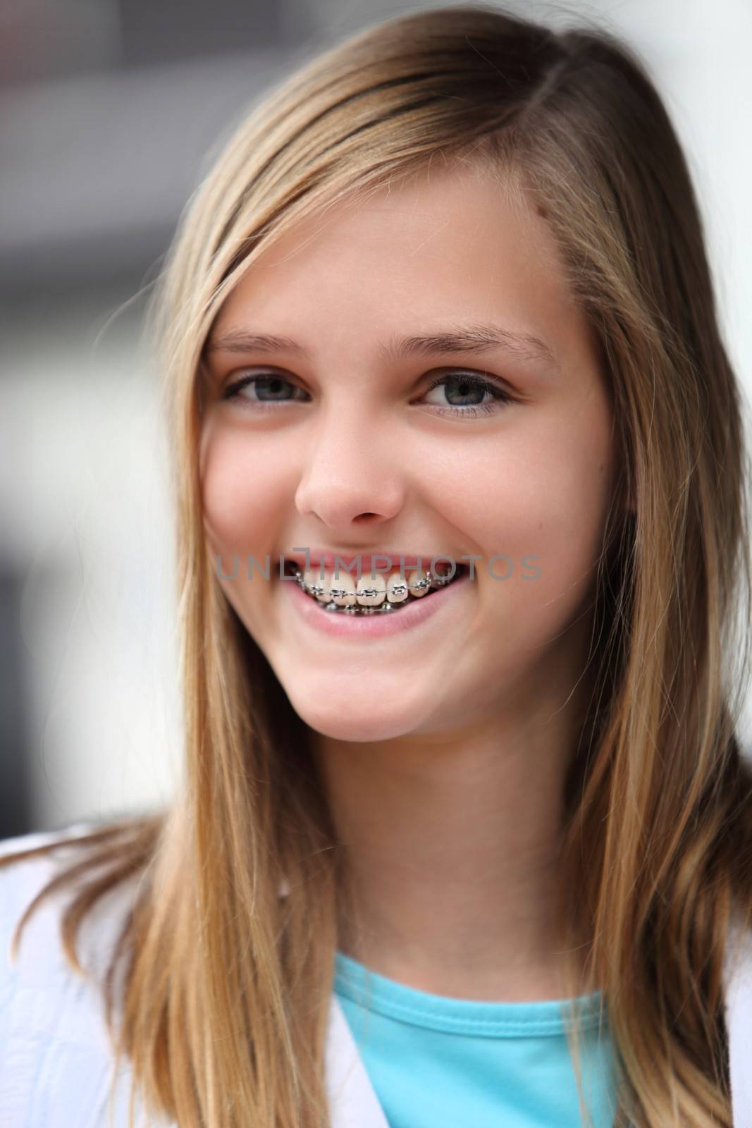 Smiling teenage girl wearing dental braces grinning to show her teeth, closeup headshot