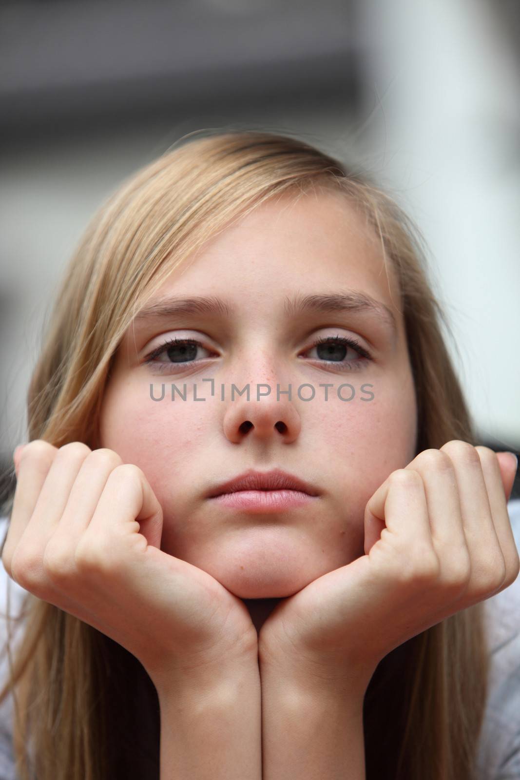 Bored young teenage girl staring at the camera with her chin resting on the palms of her hands