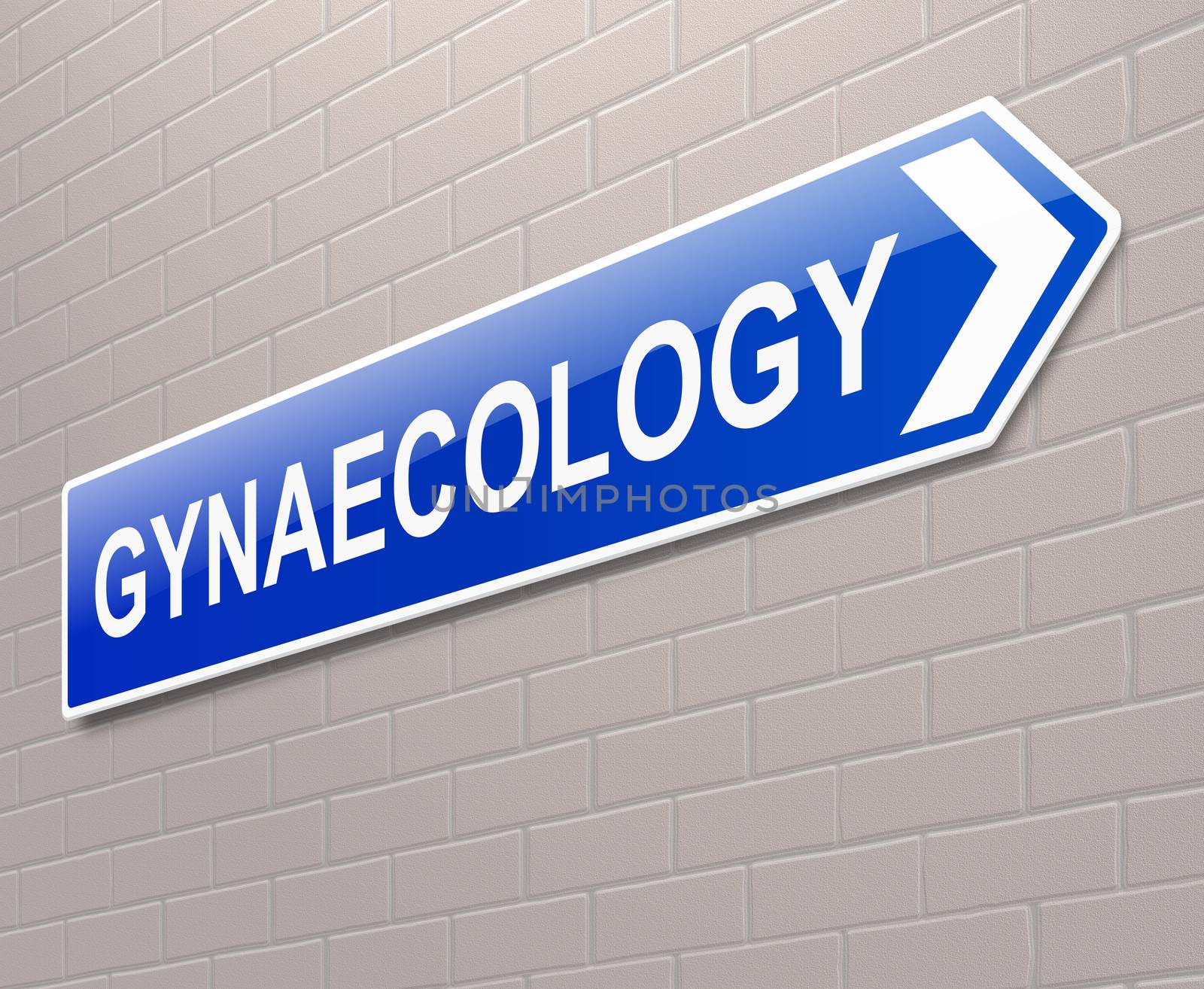 Illustration depicting a sign directing to Gynaecology.