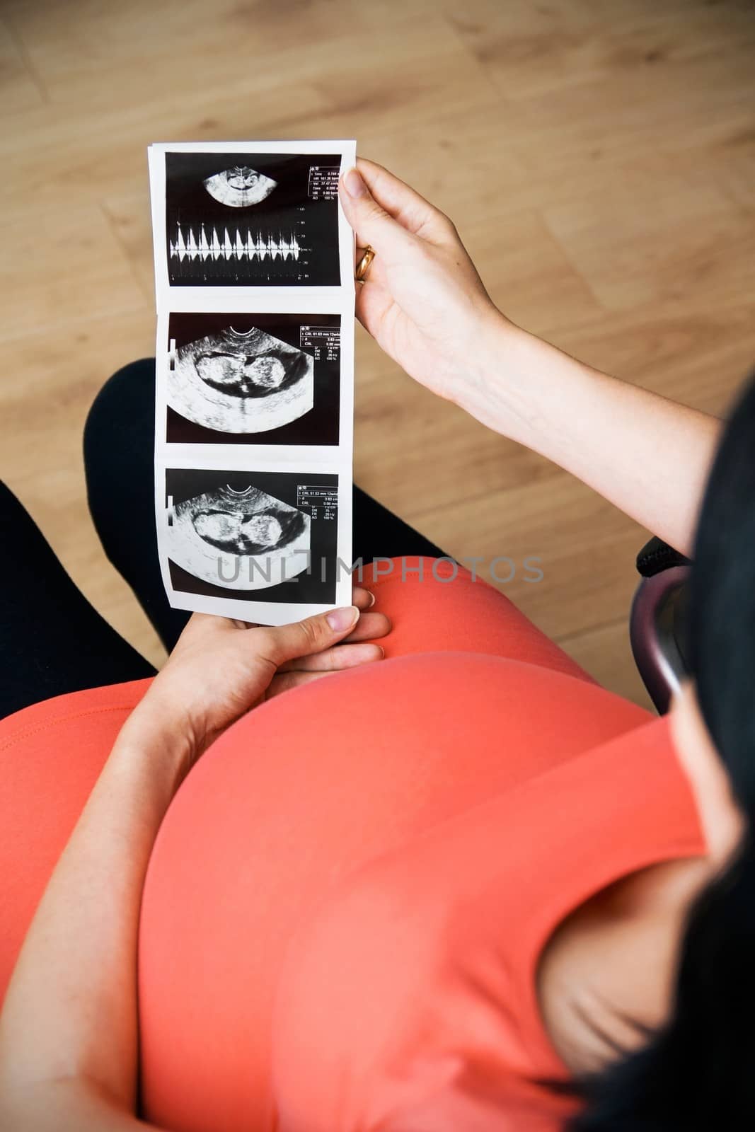 Pregnant woman looking at an ultrasound