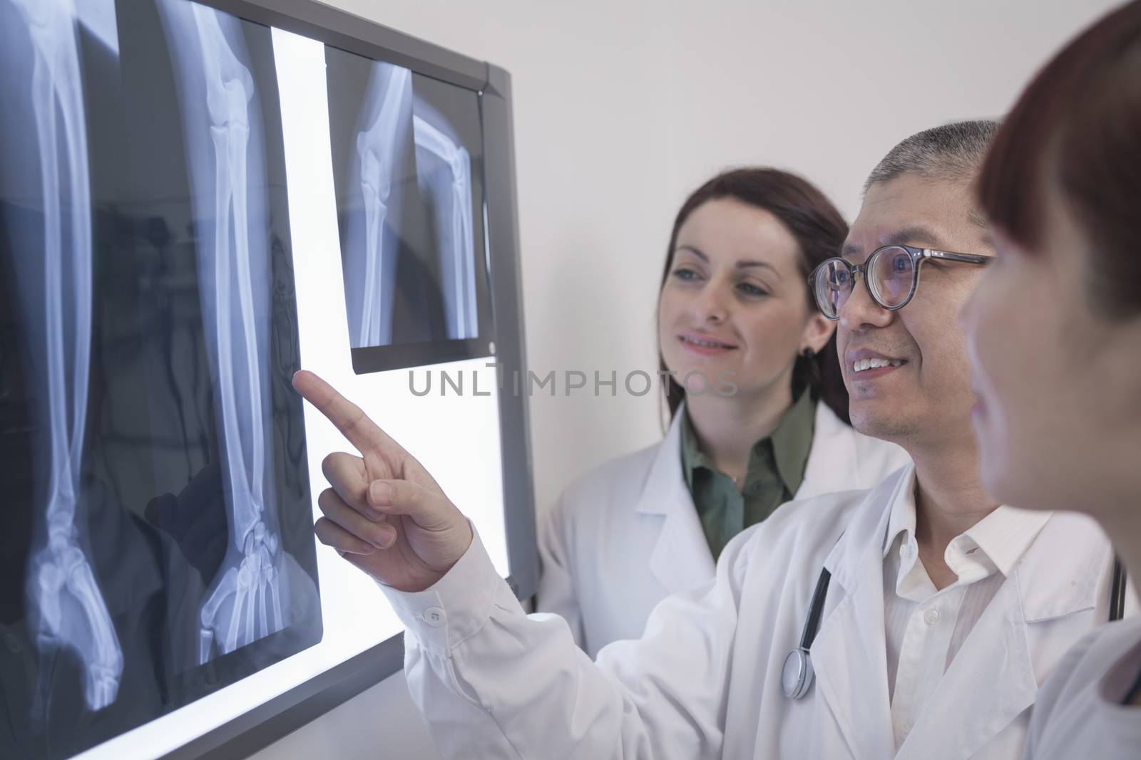 Three smiling doctors looking at x-rays of human bones, one doctor is pointing by XiXinXing