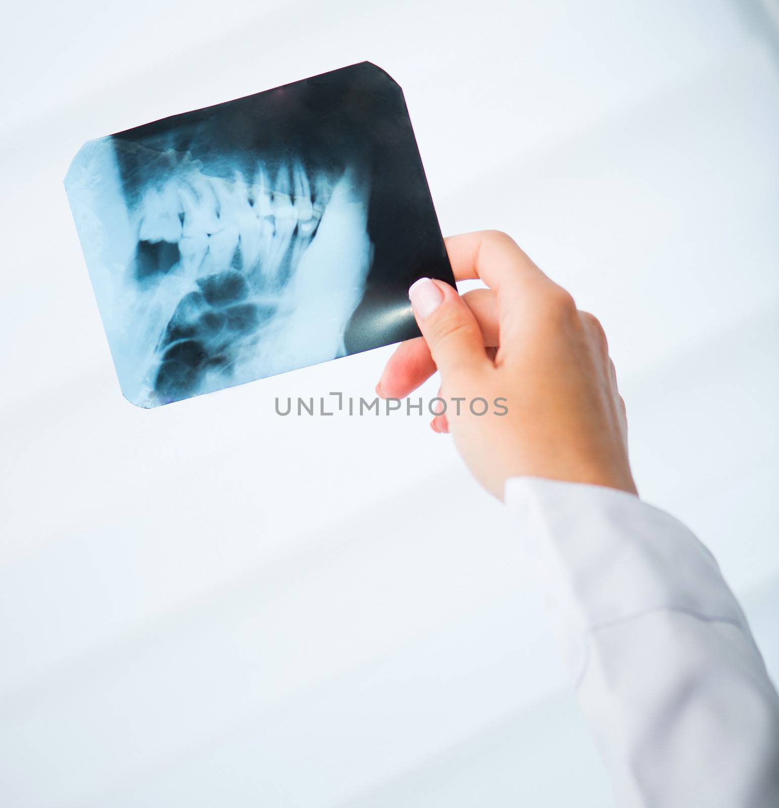 doctor's hand with x-ray jaw