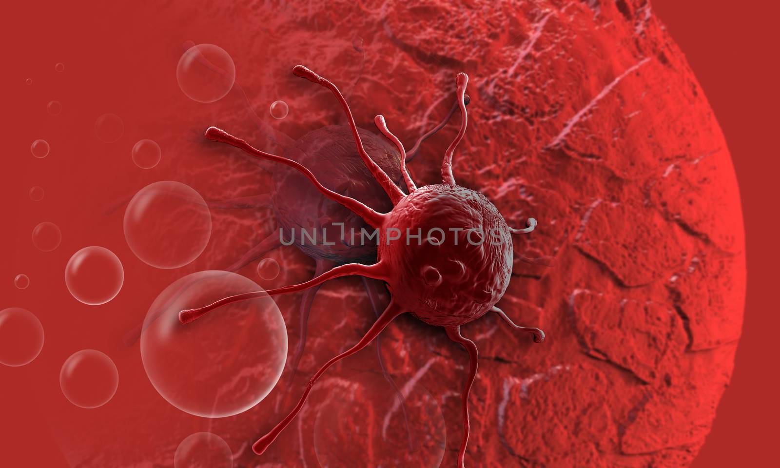 cancer cell by vitanovski