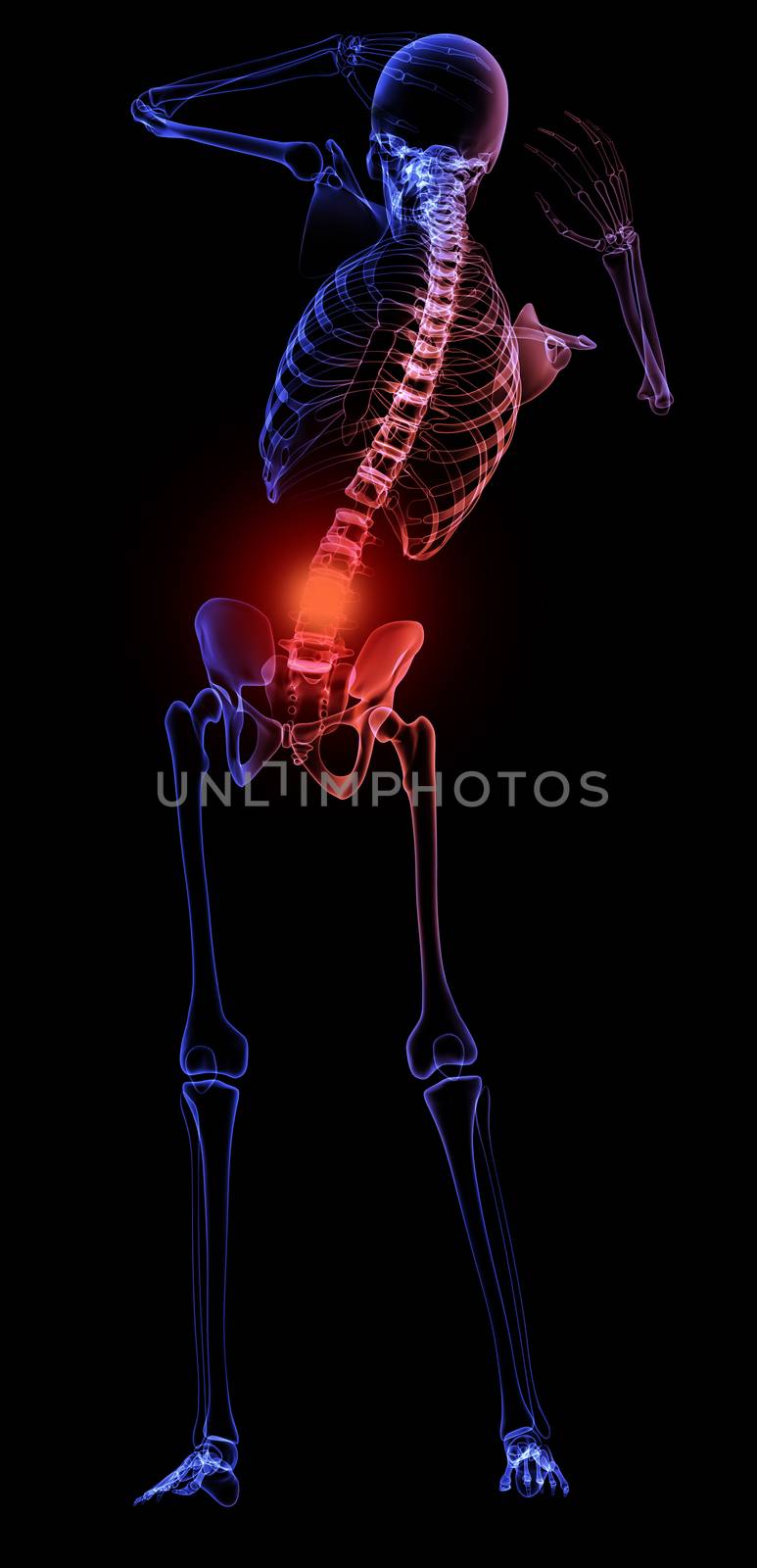 Human skeleton  with a visible pain in the lower back
