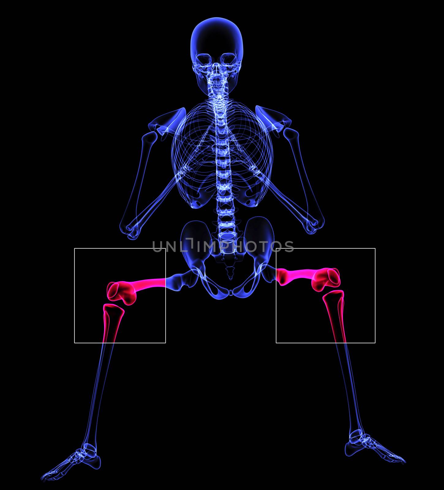 painful knee illustration made in 3d software