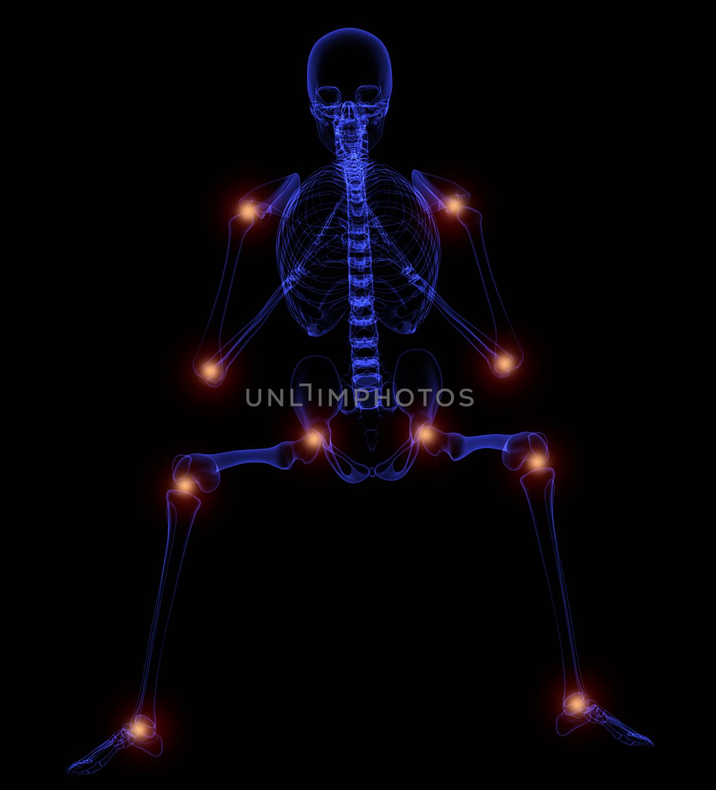 3d illustration - painful joints