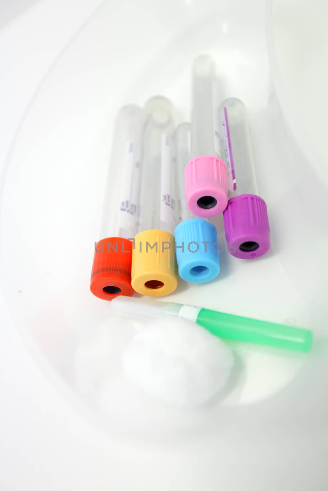 Unlabelled pathology phlebotomy, blood collecting vacutainer tubes a 21 gauge needle and cotton wool lying in a kidney dish for a blood collection procedure