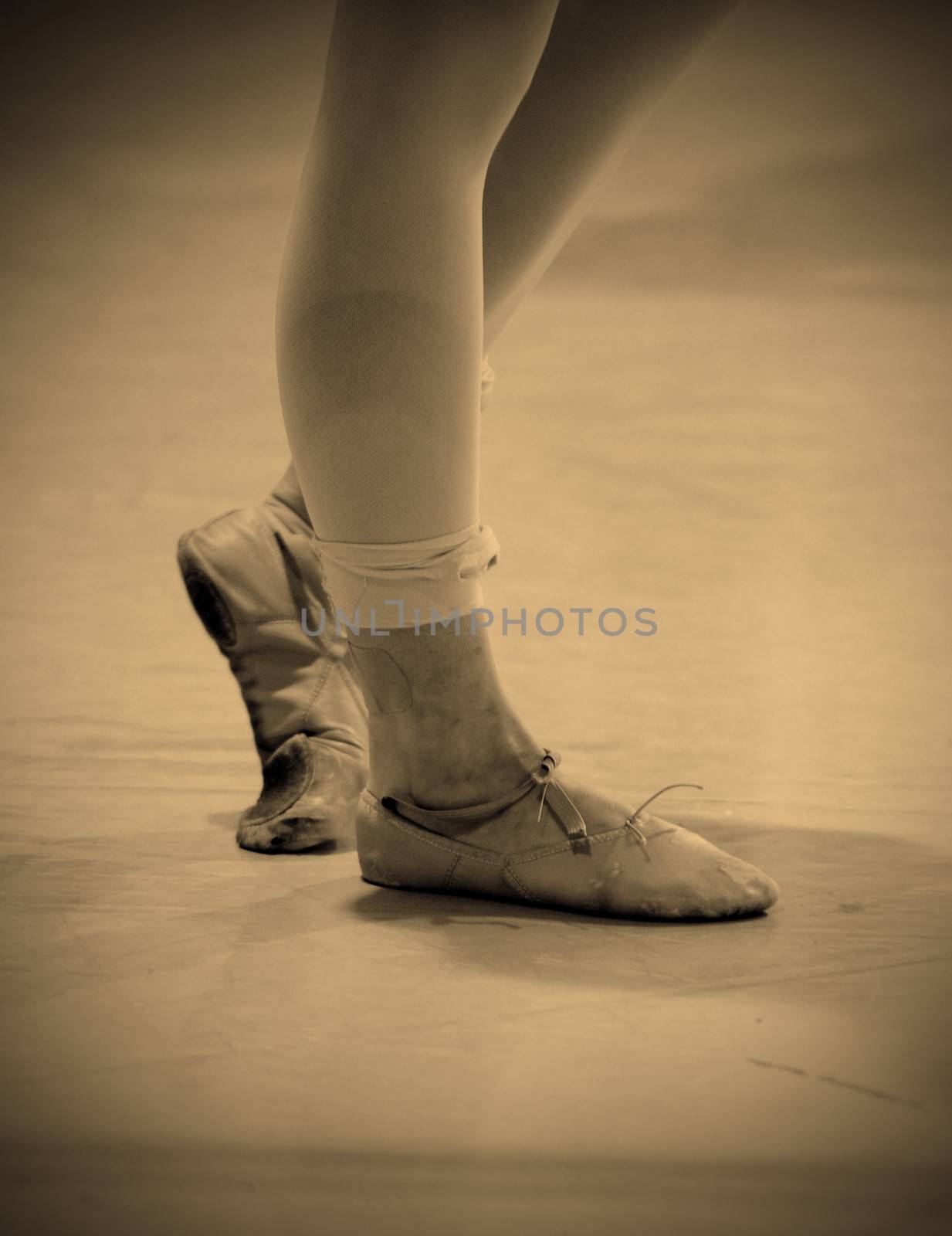 sore and battered ballet dancer's feet by ftlaudgirl