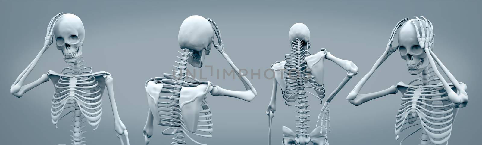 Skeletons having headaches against a grey background