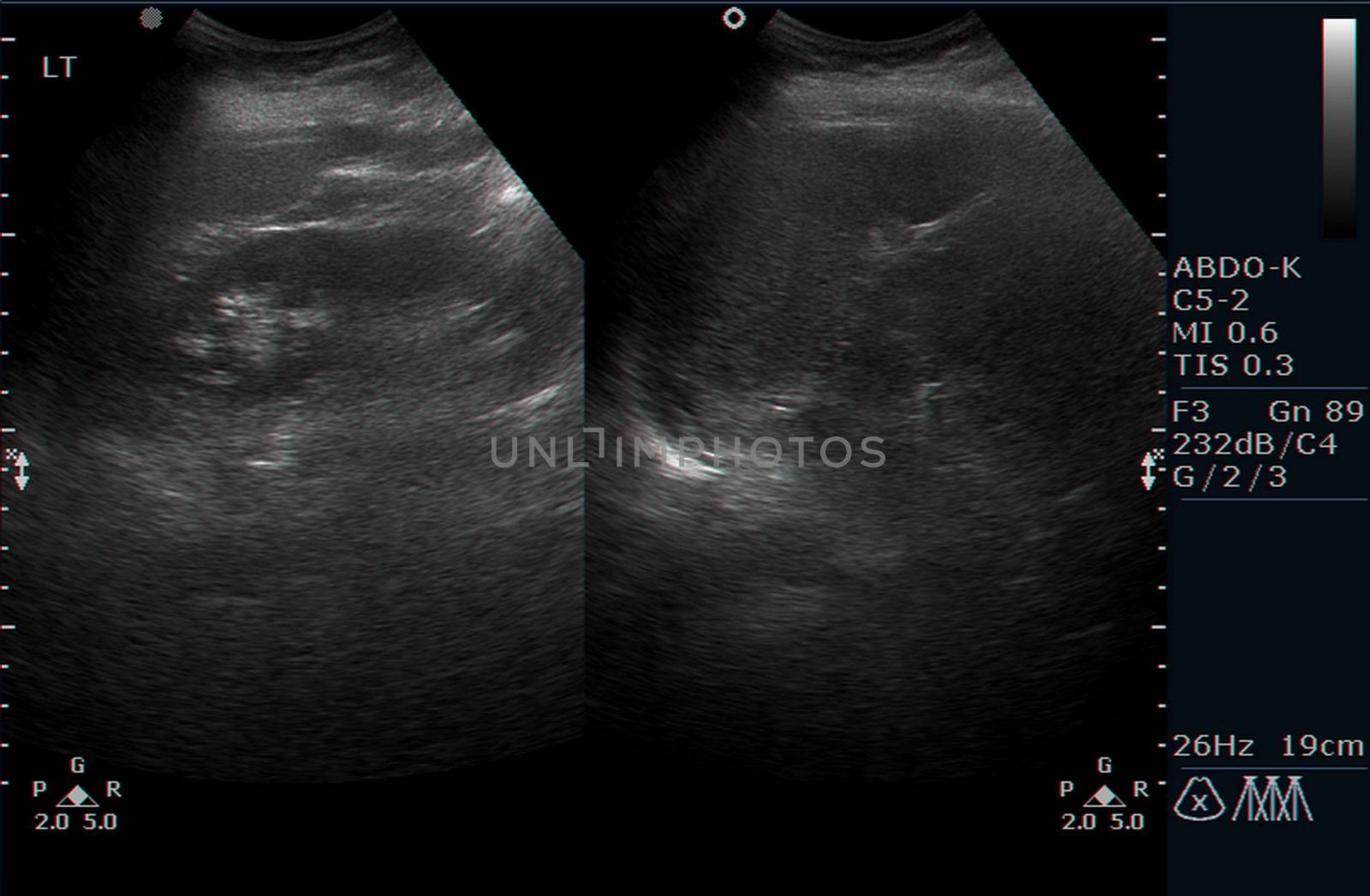 Ultrasound examination of  human internal organs