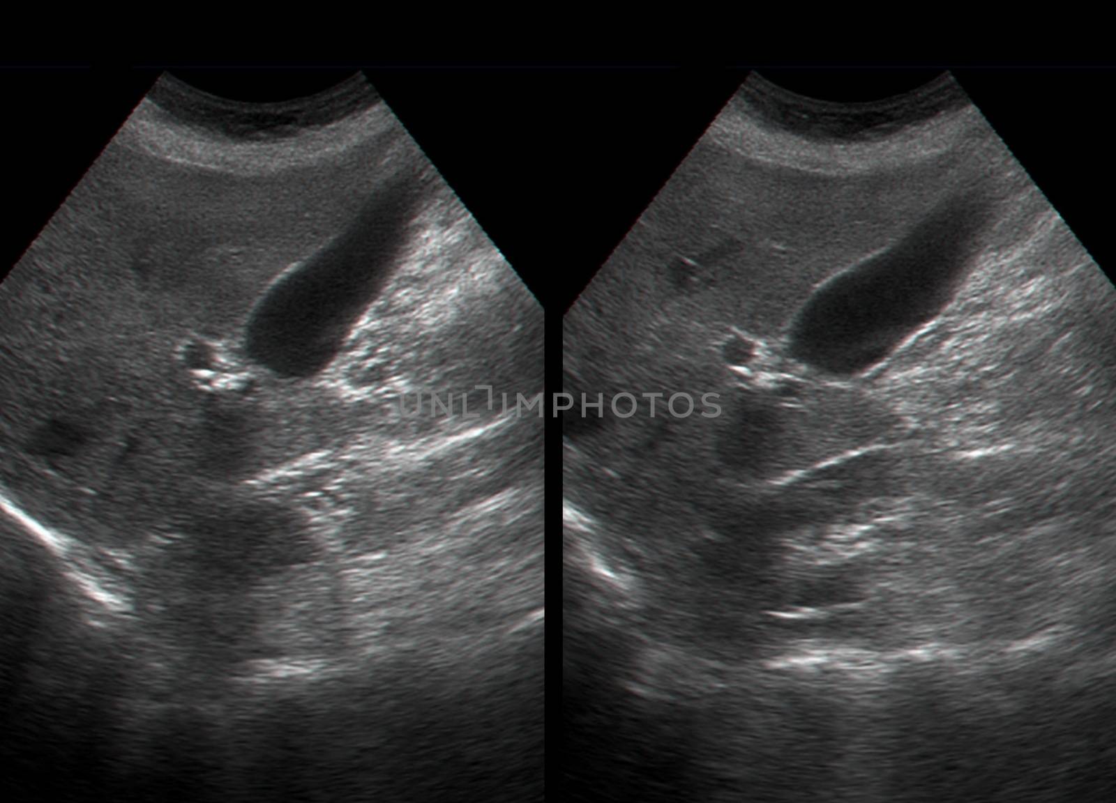 Ultrasound examination of  human internal organs