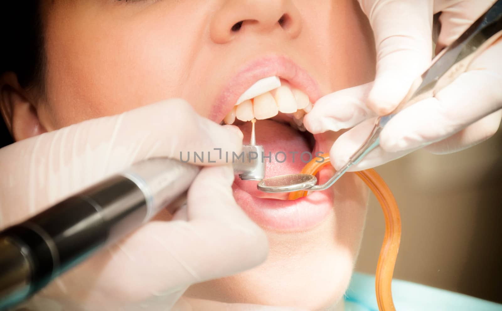 Female and dentist by badmanproduction