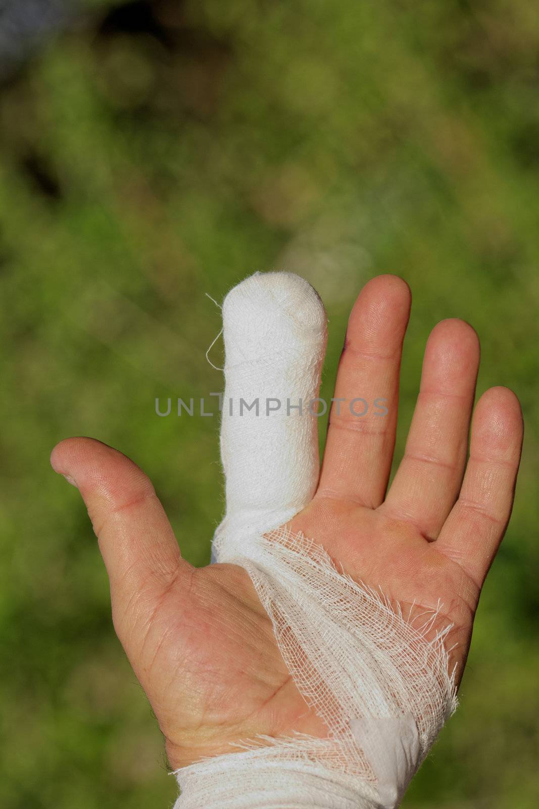 White medicine bandage on human injury hand finger by NagyDodo