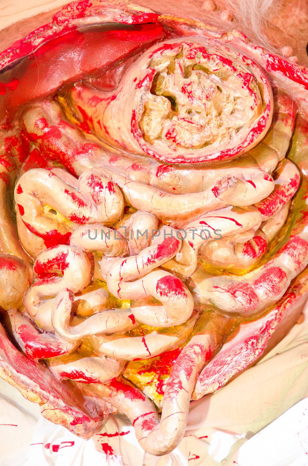 intestinal internal organ of man