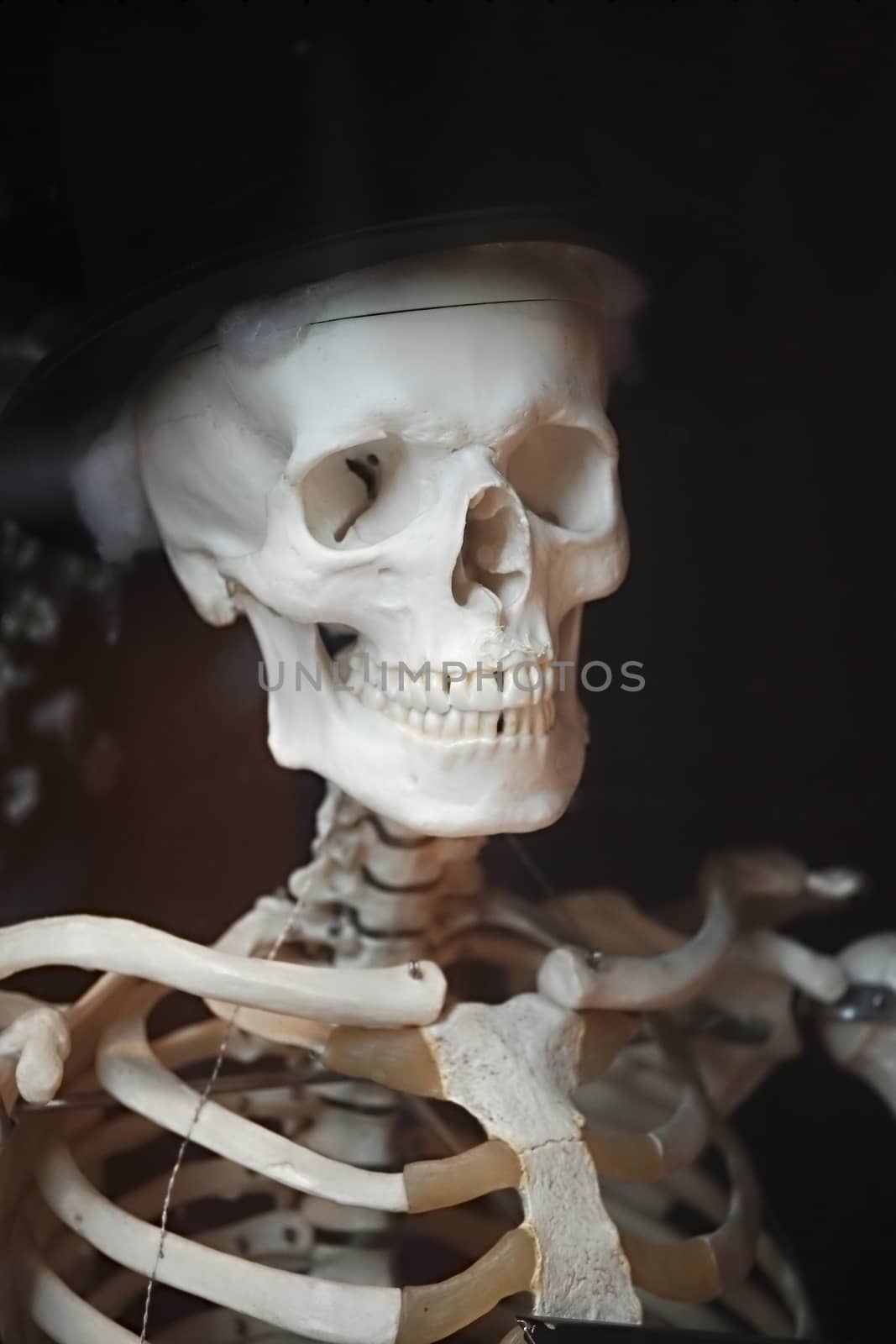The upper part of human skeleton