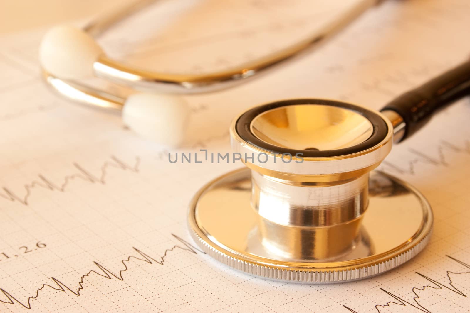 A stethoscope on a printout of a heart monitor