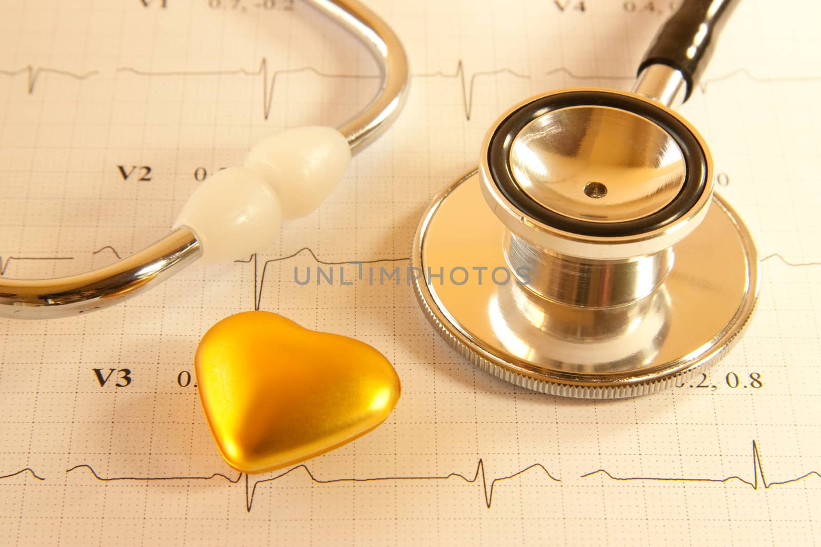 A stethoscope on a printout of a heart monitor