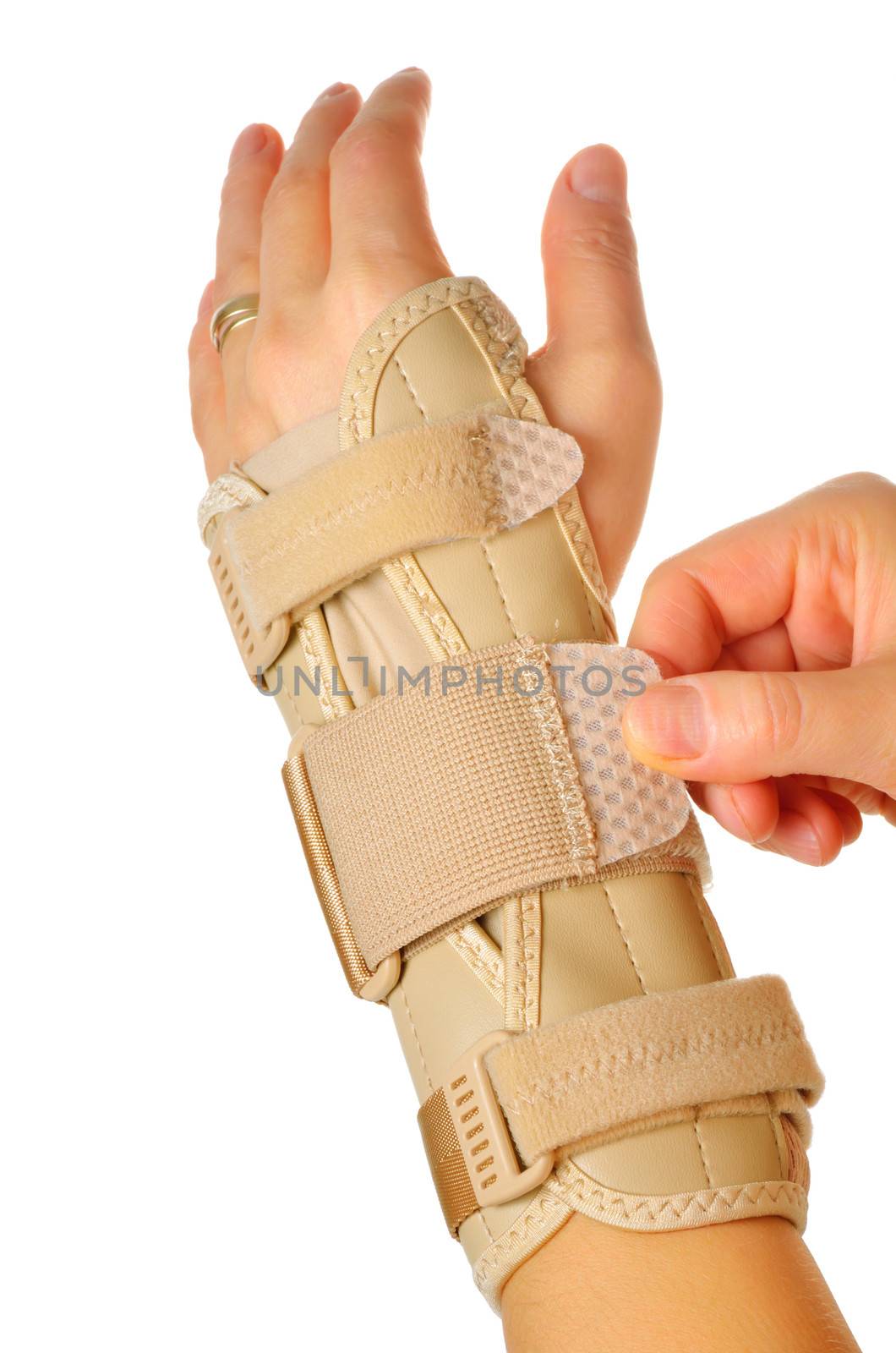 Velcro Straps on a Carpal Tunnel Support Wrist Brace