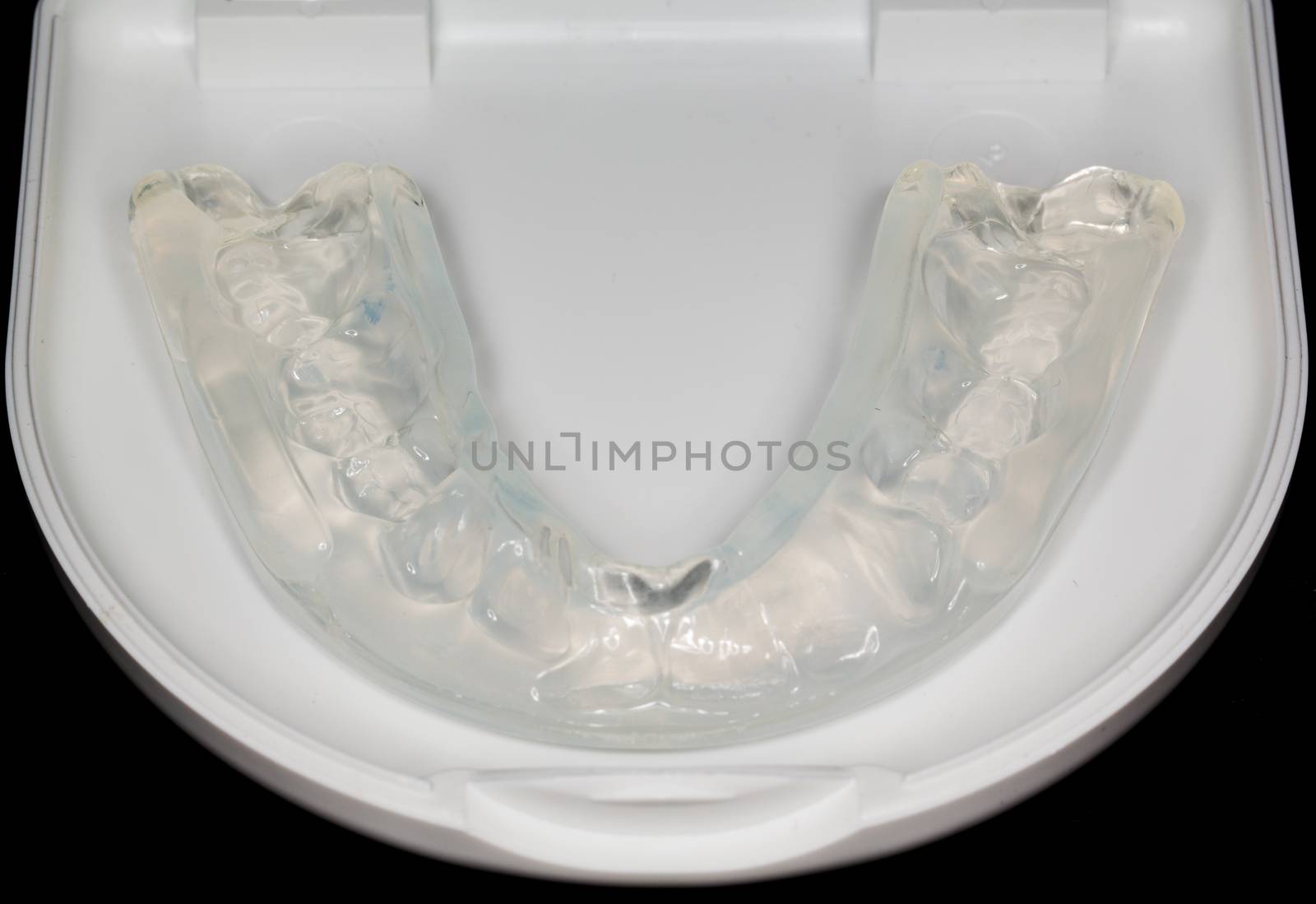 Macro close up of a plastic teethguard to stop wear due to teeth grinding at night. Often caused by tension and worry.