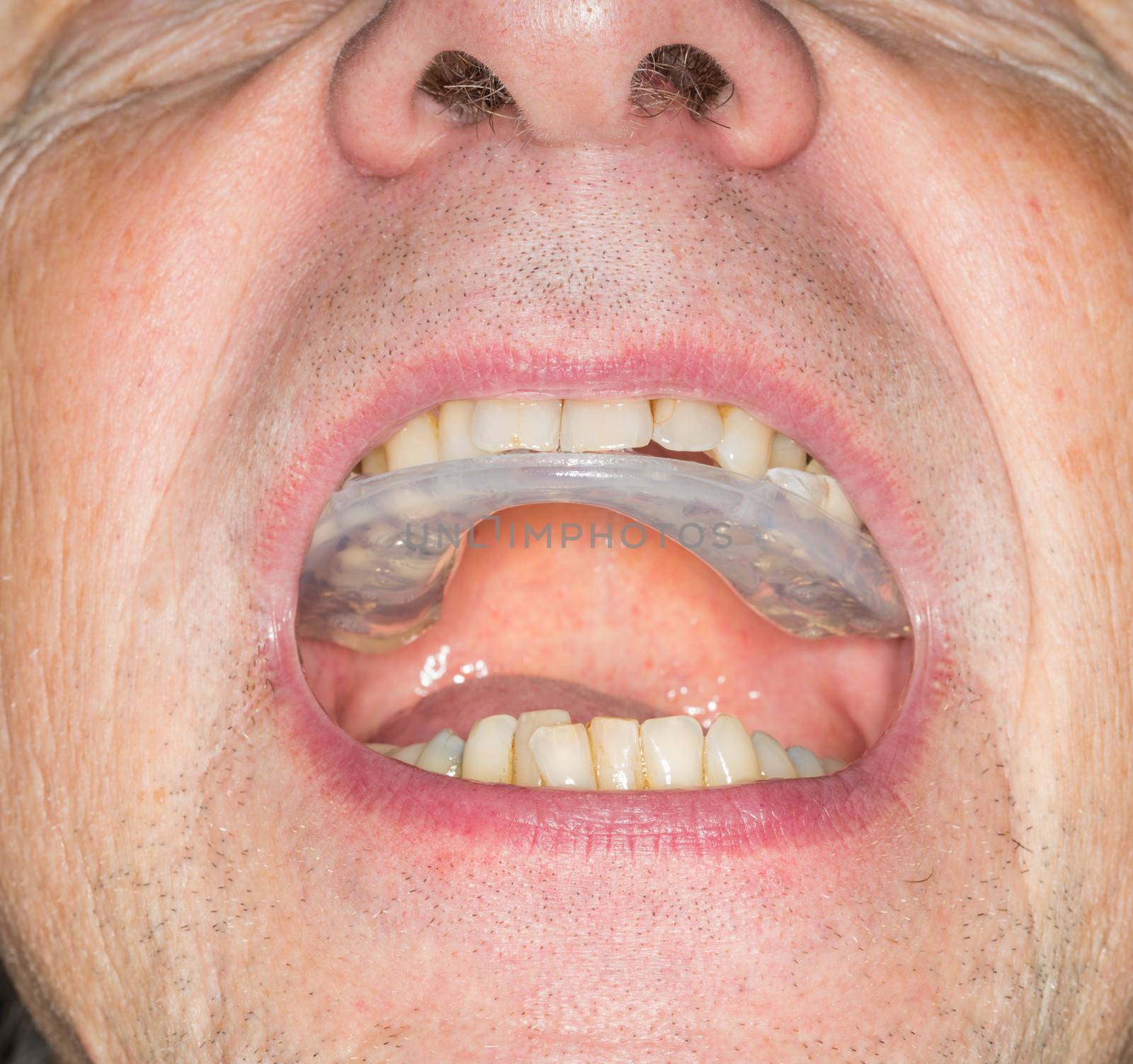 Close up of teeth guard in senior mouth by steheap