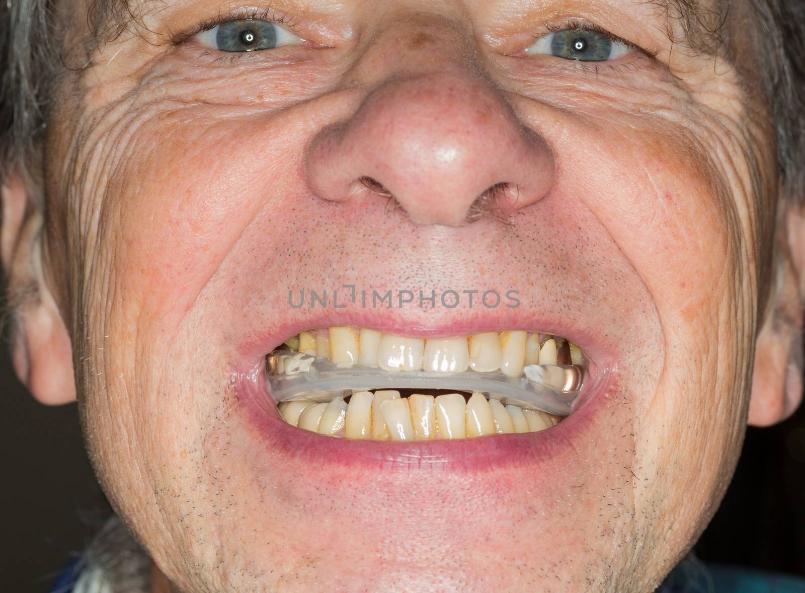 Close up of teeth guard in senior mouth by steheap