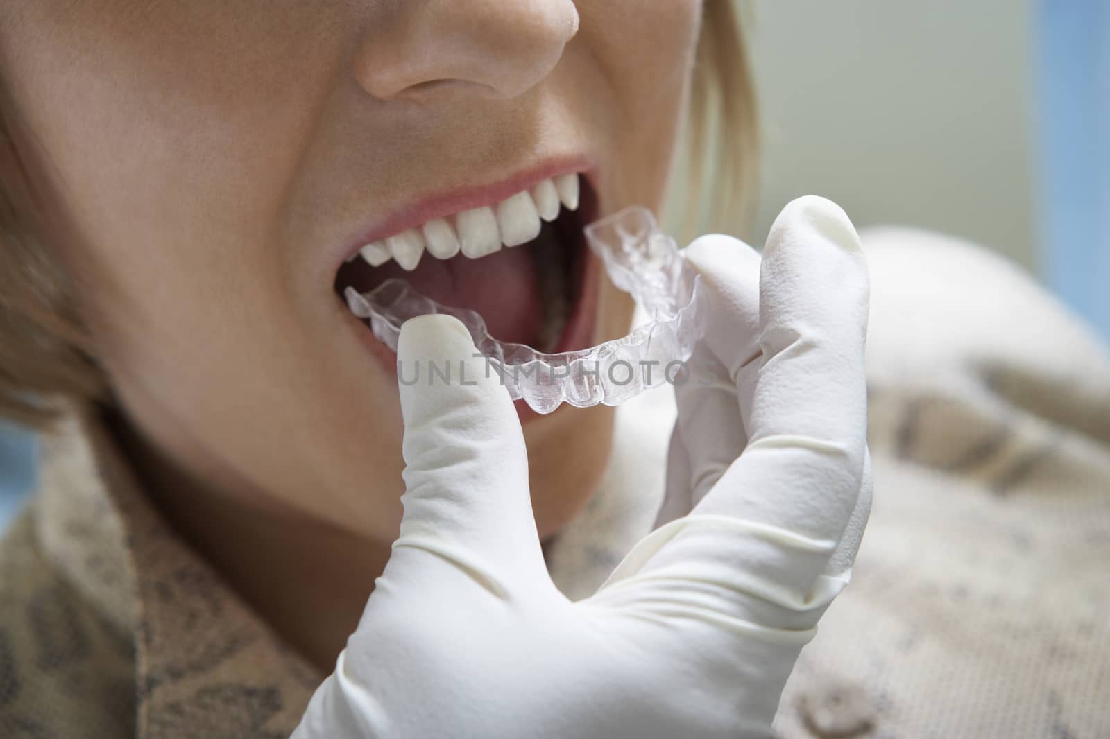 Close-up of dentist's hand placing plastic braces by moodboard