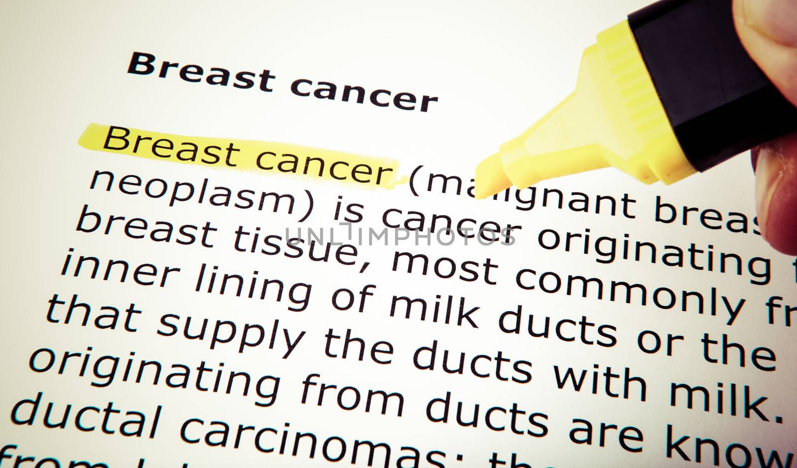 Breast cancer