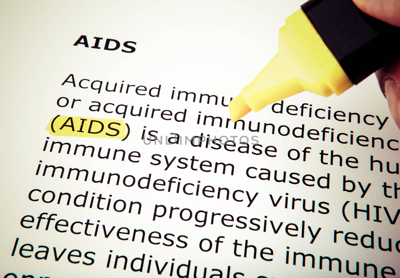 AIDS