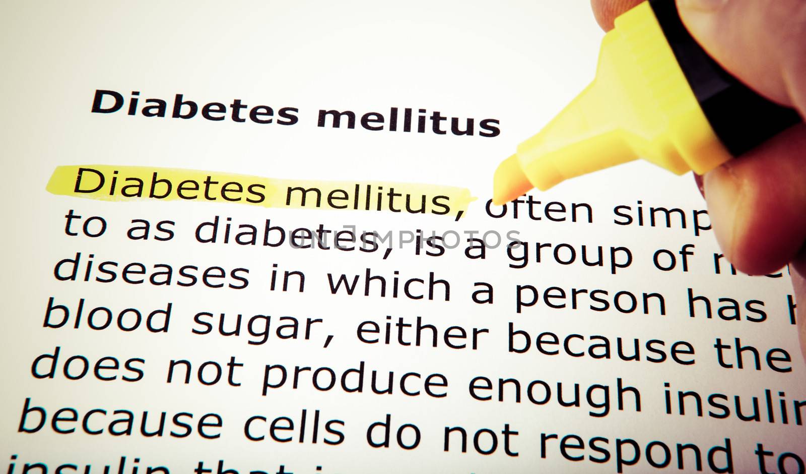Diabetes mellitus