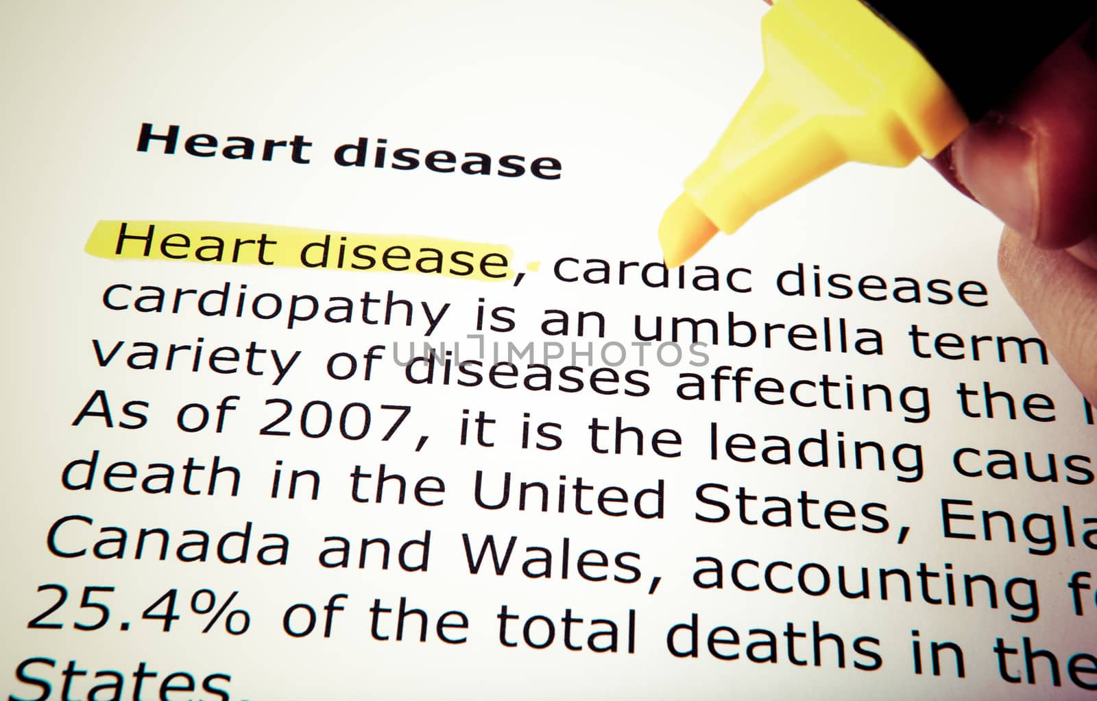 Heart disease
