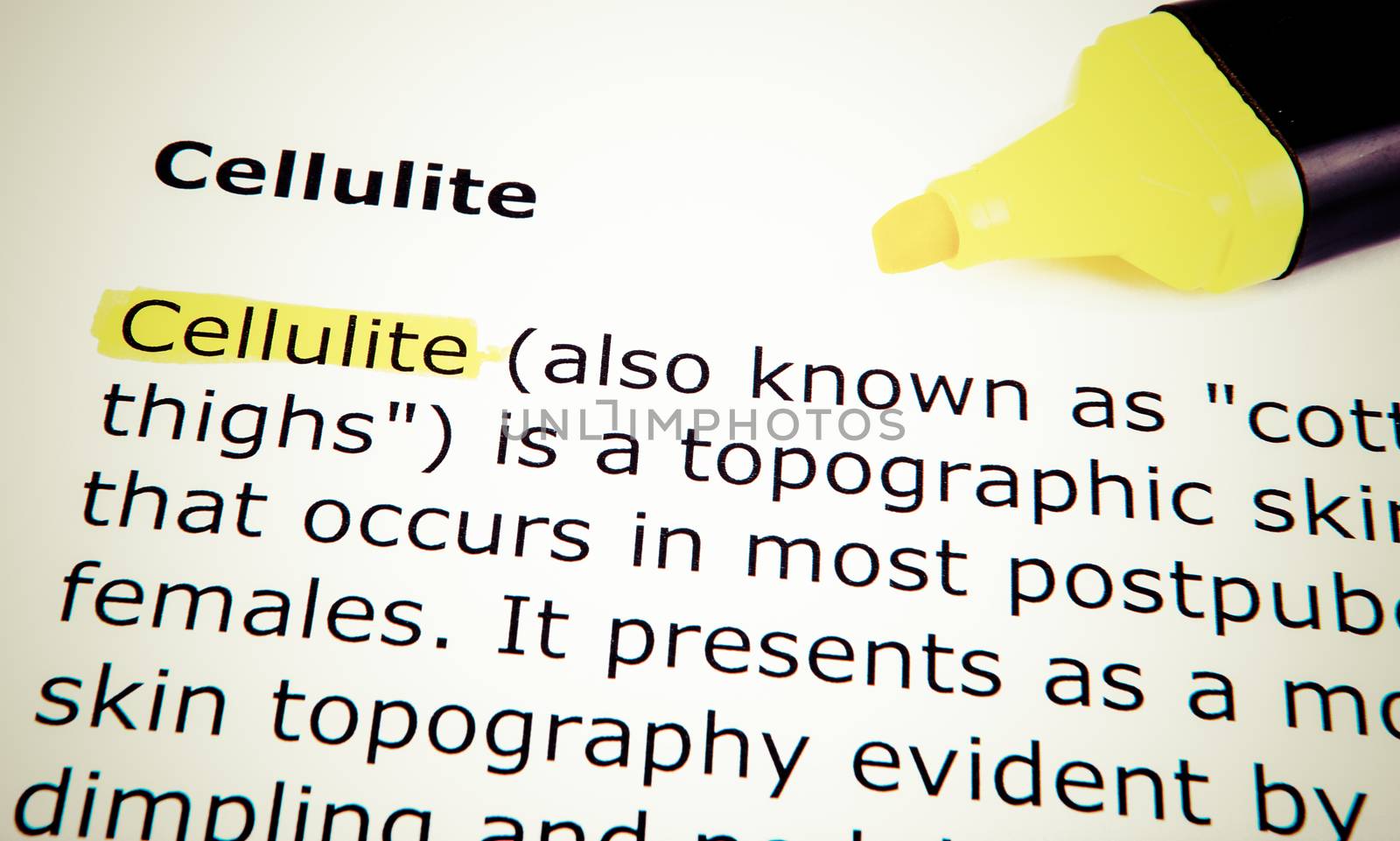 Cellulite