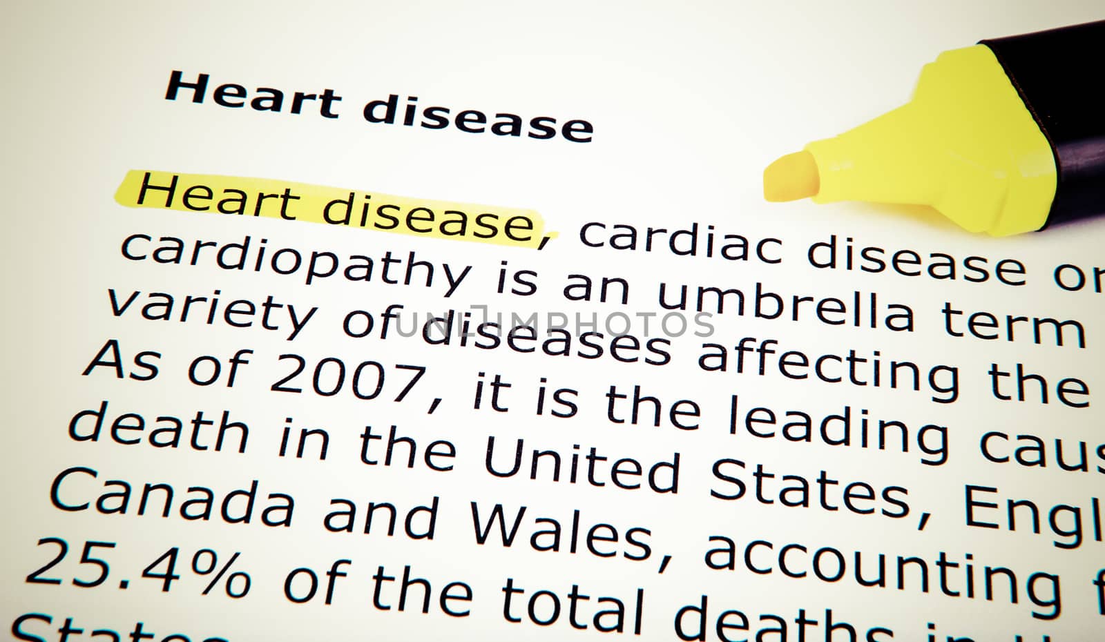 Heart disease