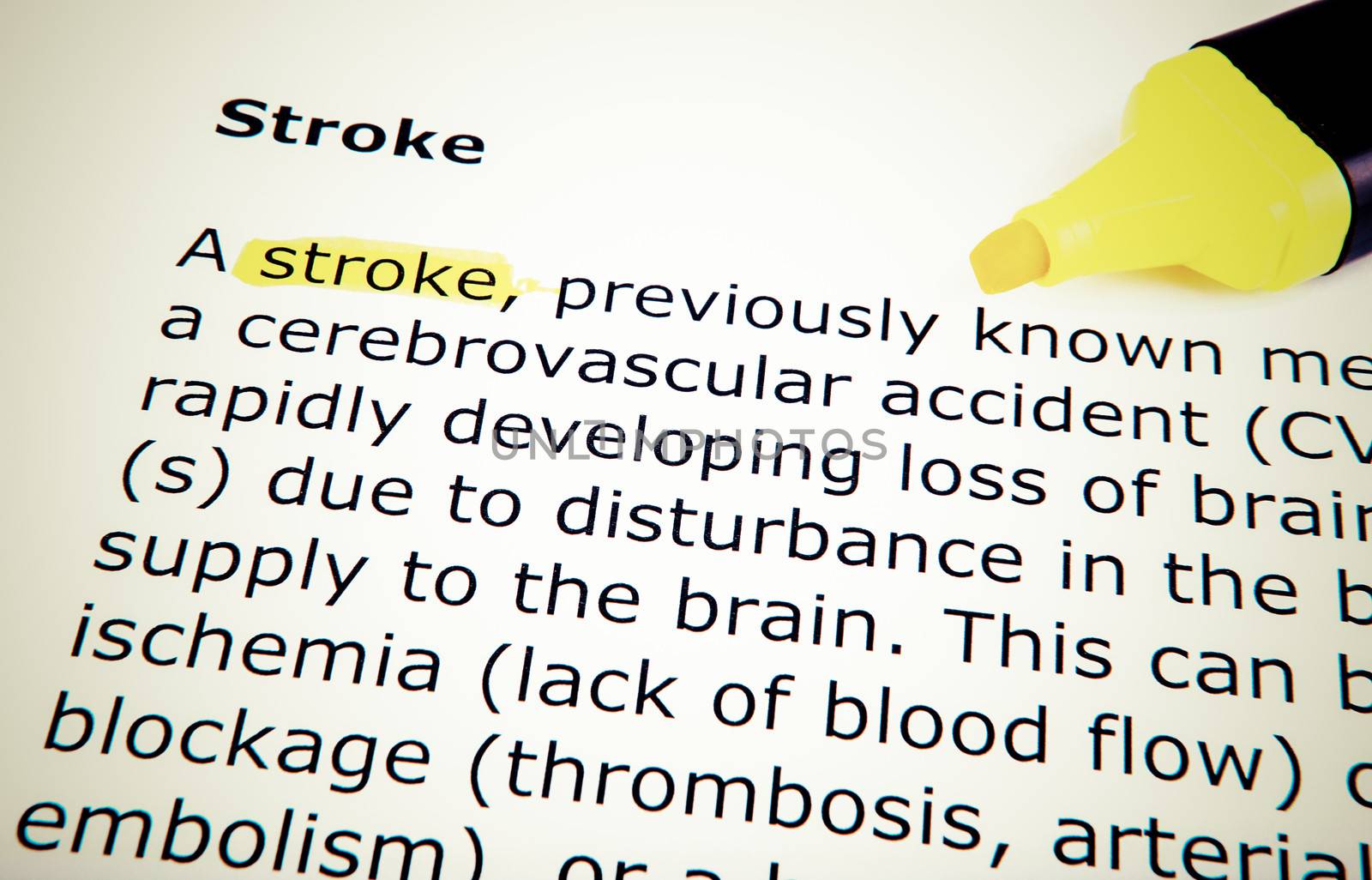 Stroke
