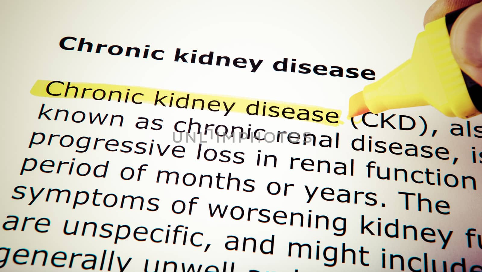 Chronic kidney disease by nenov
