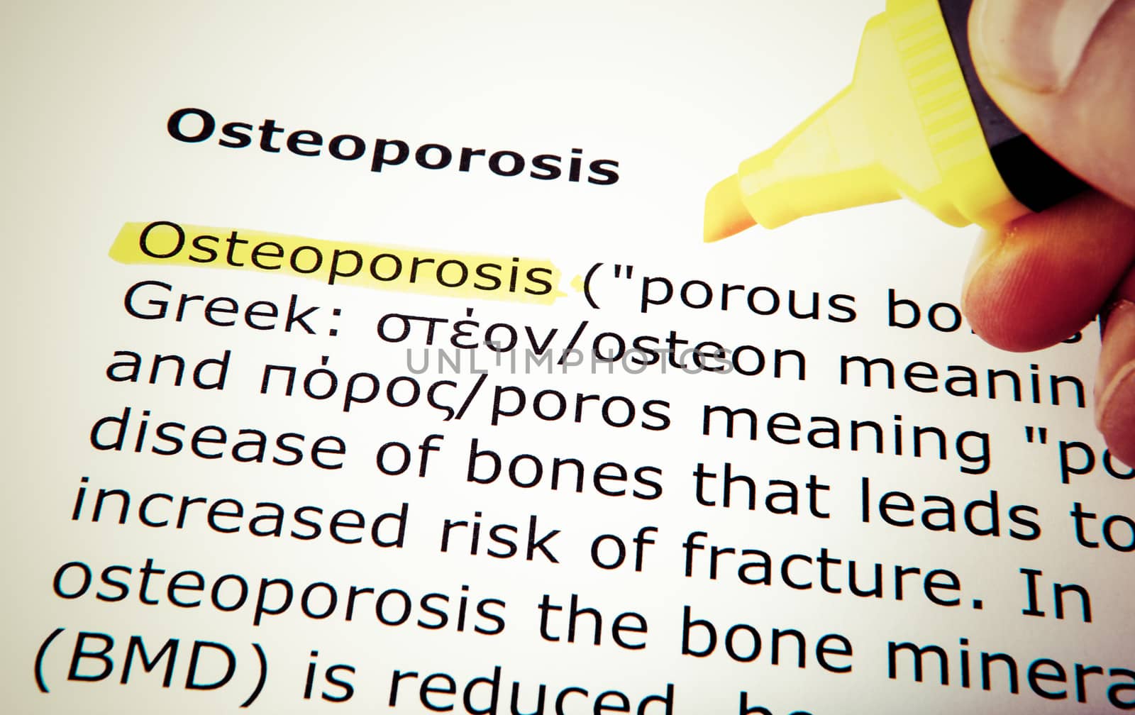 Osteoporosis