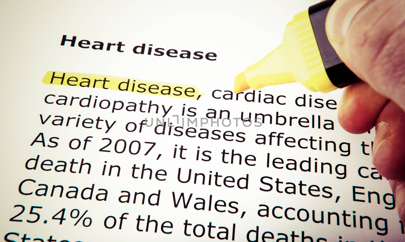 Heart disease