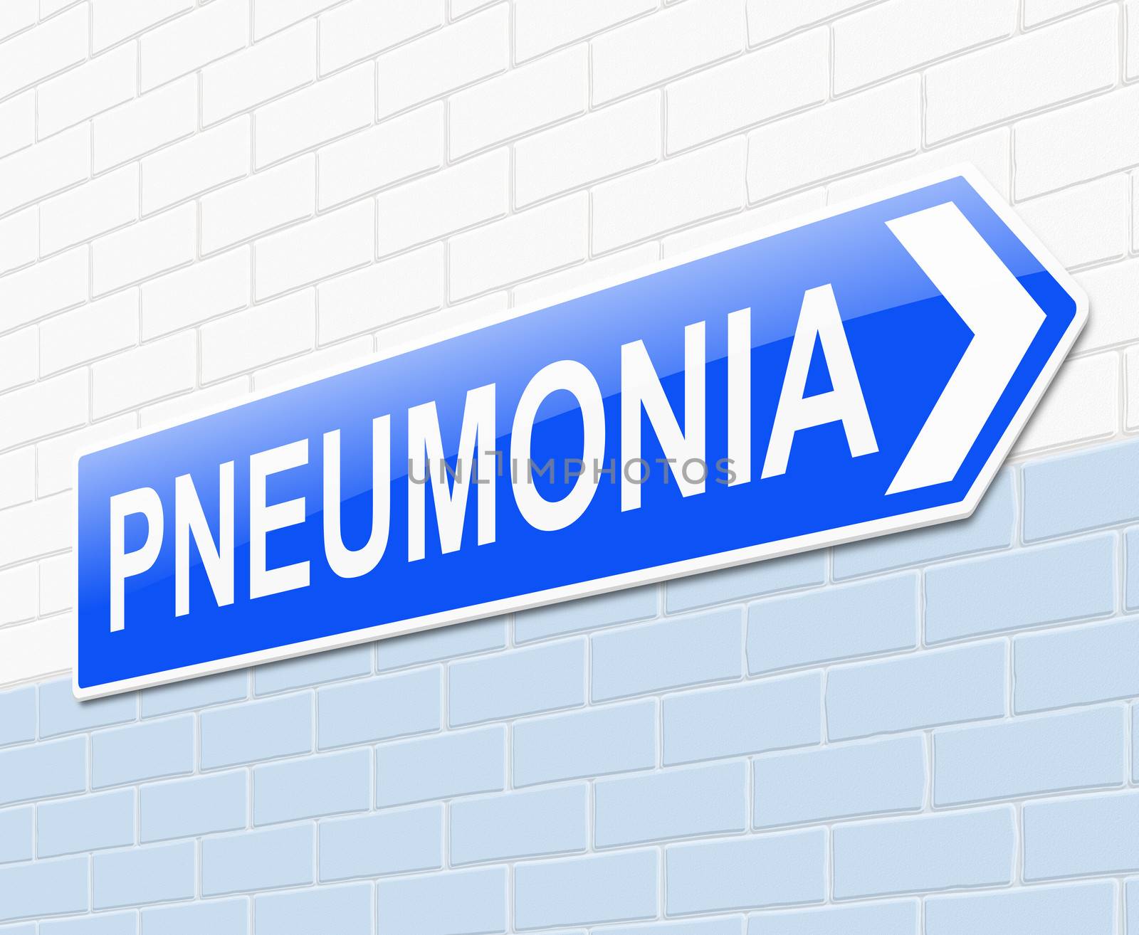 Illustration depicting a sign with a pneumonia concept.