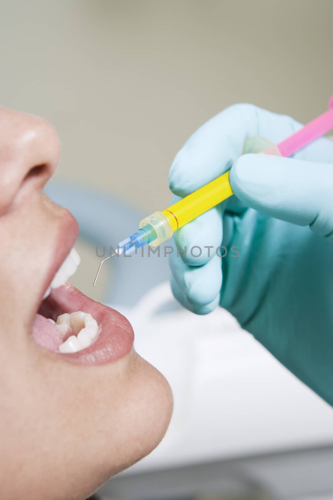Closeup of female patient's teeth being injected for treatment by moodboard