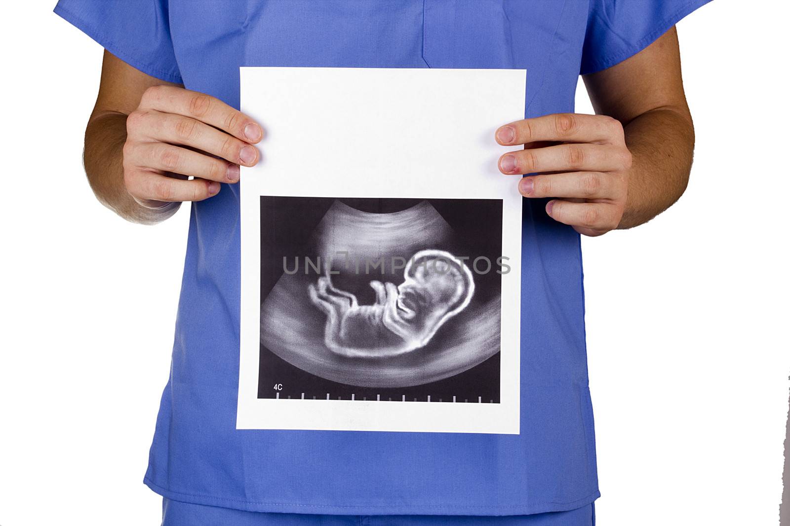 Doctor holding a baby picture of the fetus.