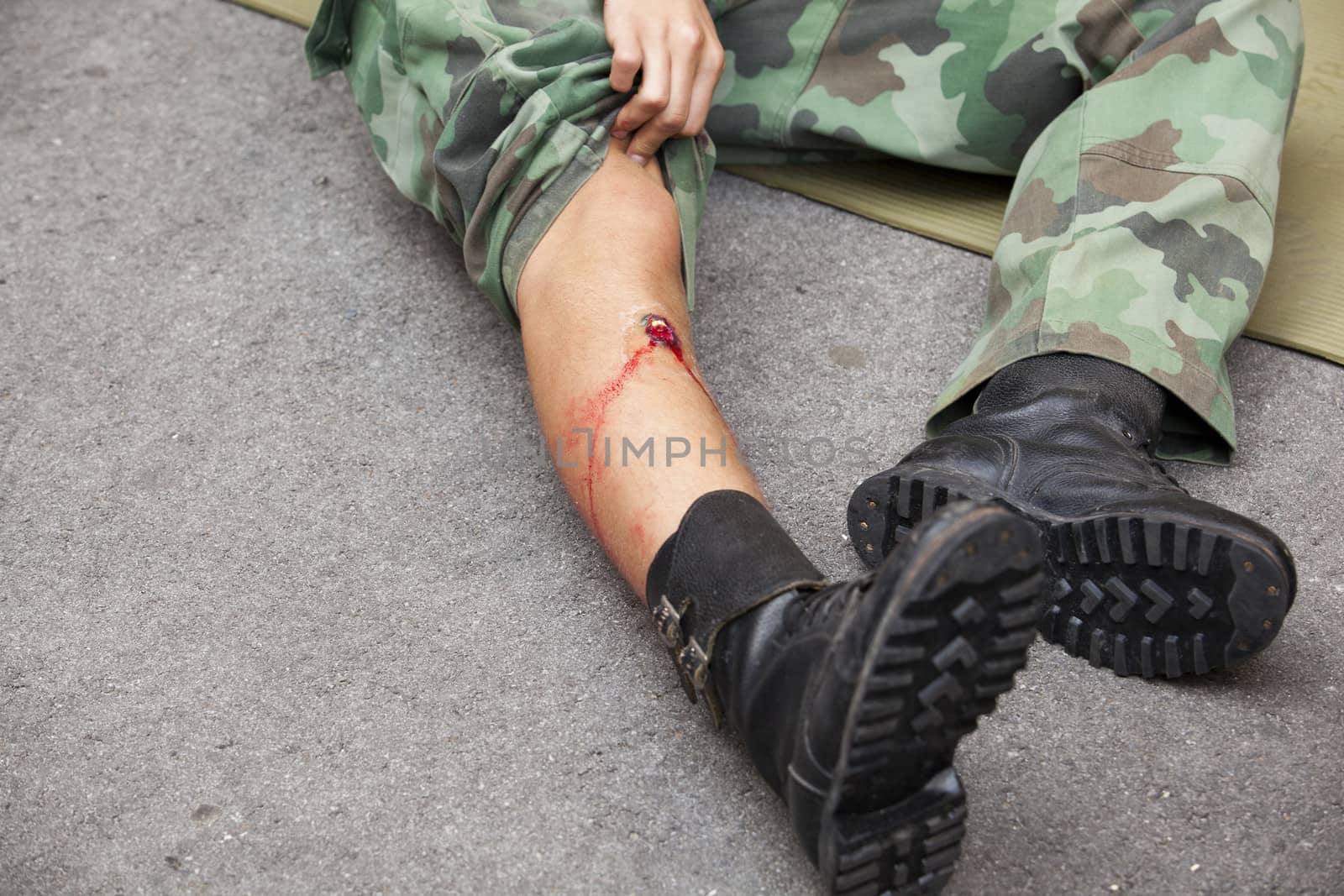 Gunshot wound on soldier's leg
