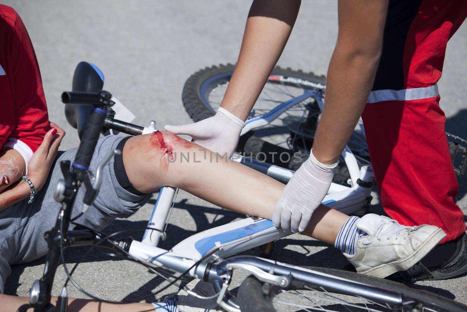 Serious injury on boy's legs