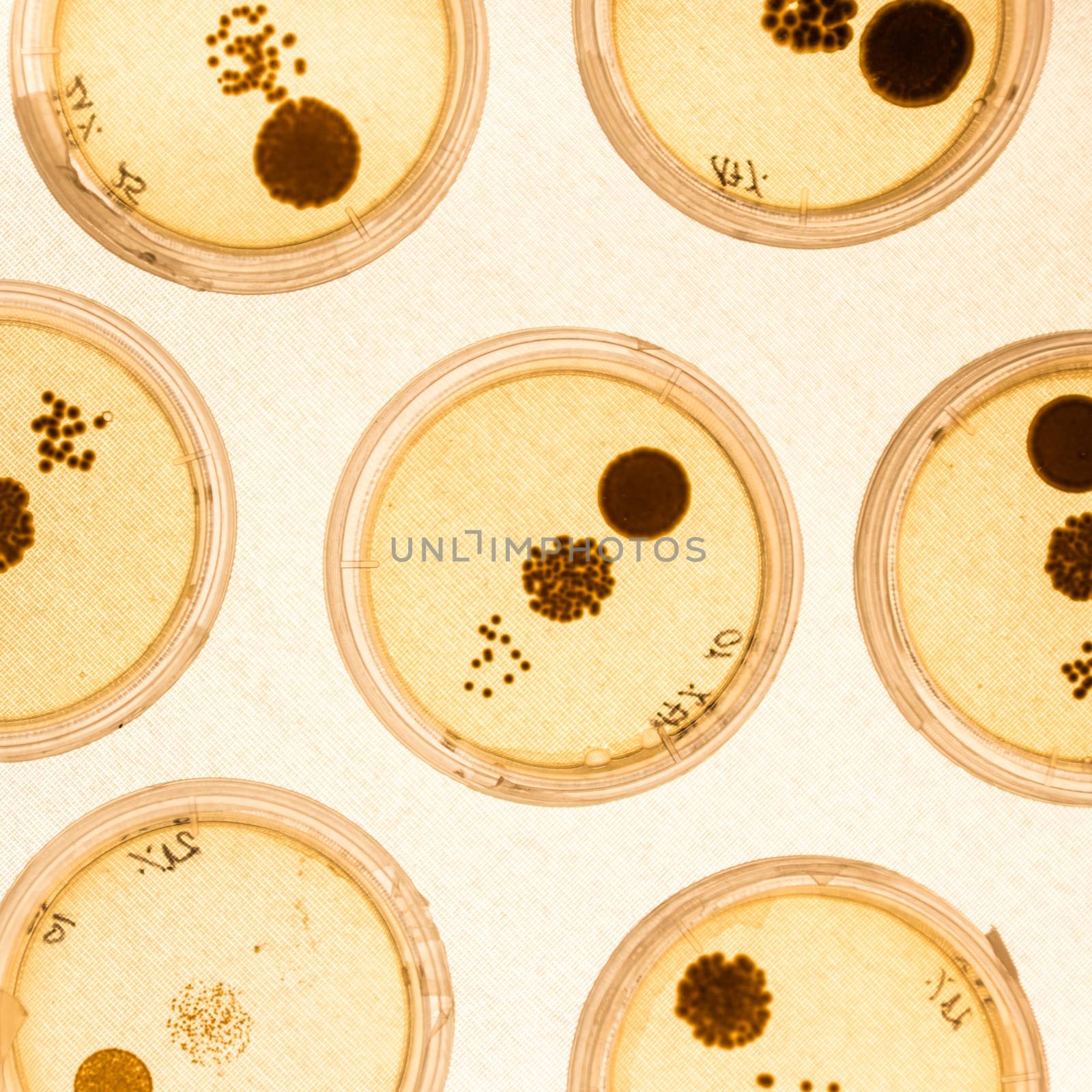 Growing Bacteria in Petri Dishes on agar gel as a part of scientific experiment.