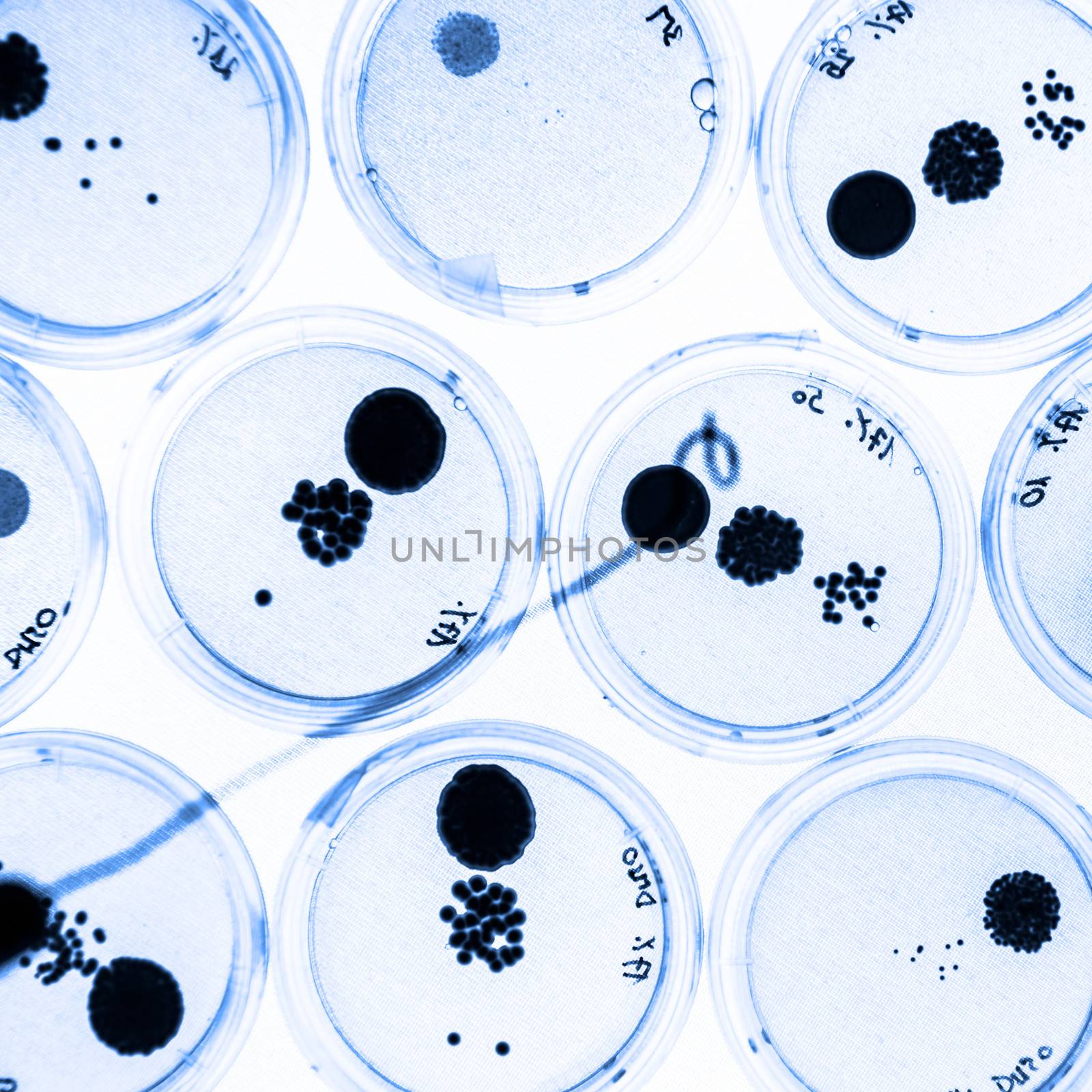 Growing Bacteria in Petri Dishes on agar gel as a part of scientific experiment.