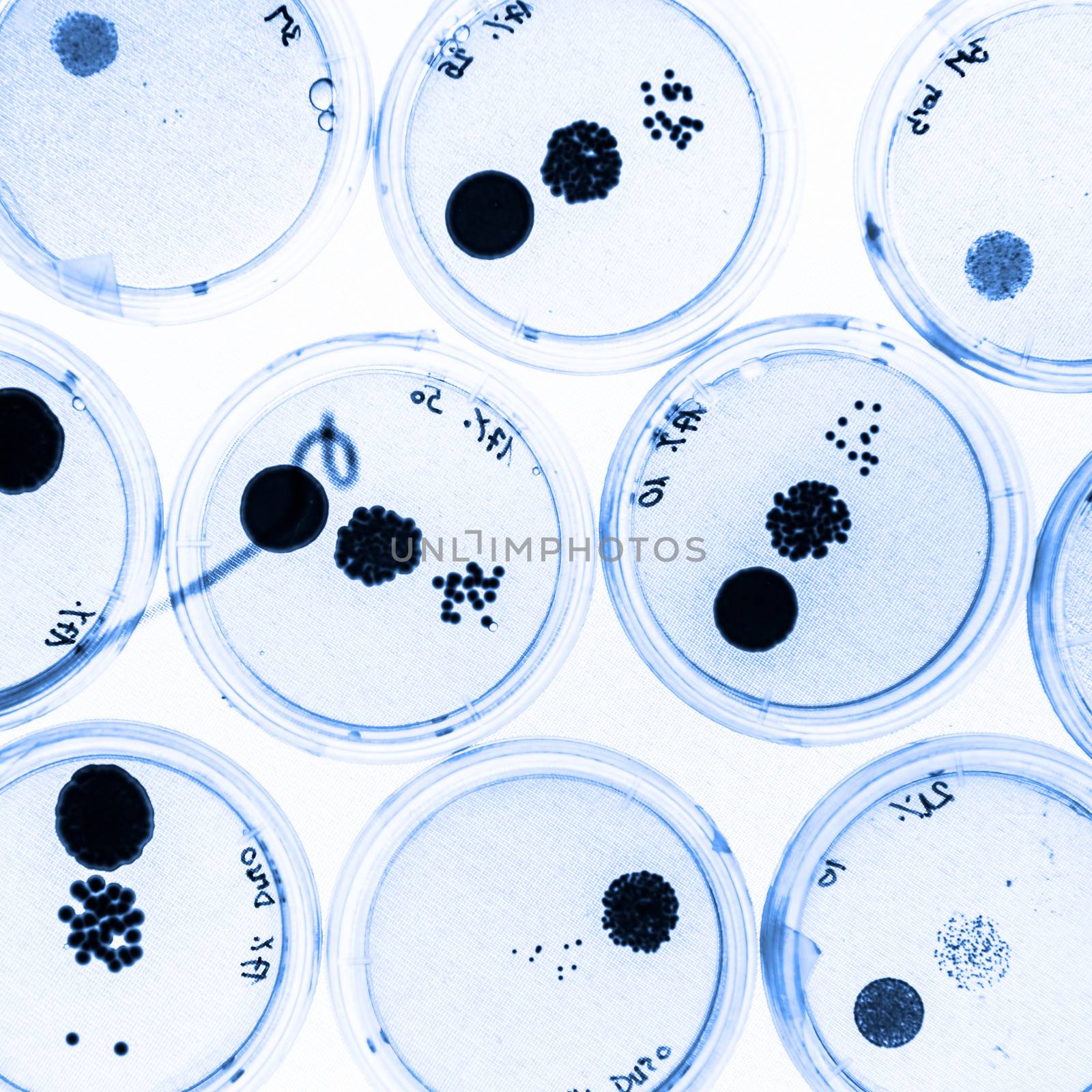 Growing Bacteria in Petri Dishes on agar gel as a part of scientific experiment.