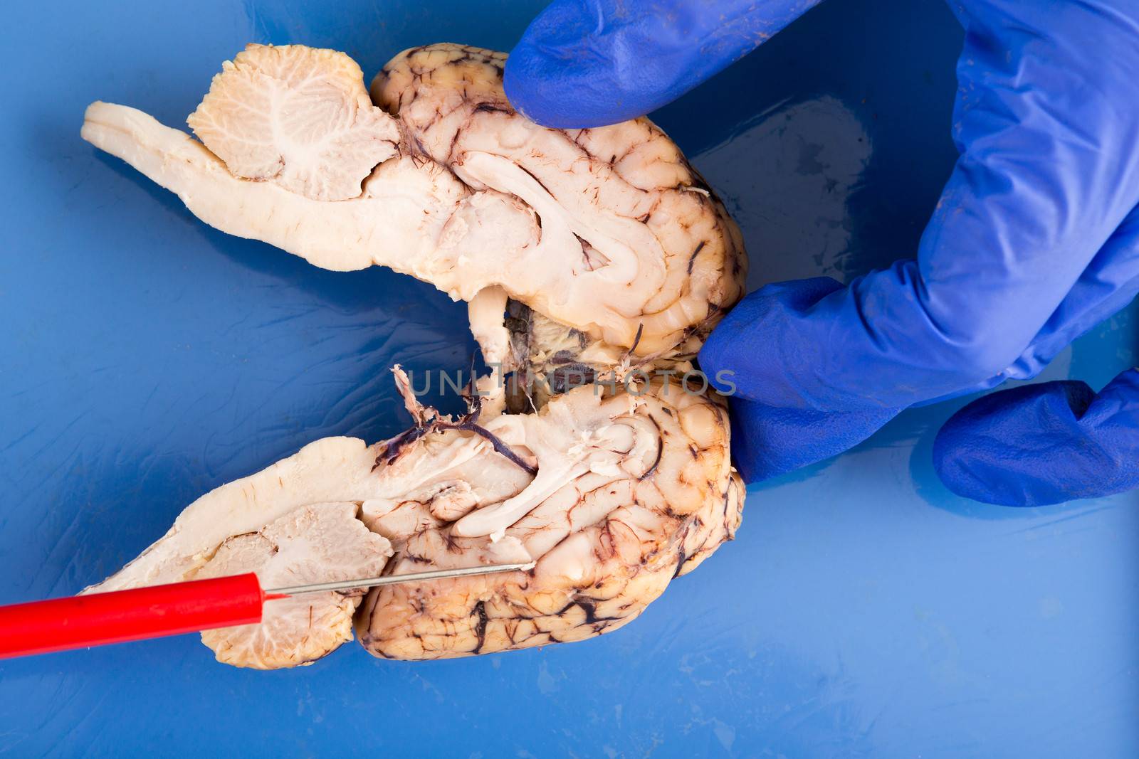 Longitudinal cross-section of a cow brain by coskun