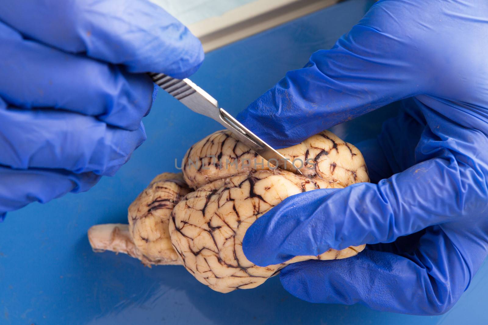 Close up of the gloved hands of an anatomy student, veterinarian, medical technologist or pathologist dissecting a cow brain with a surgical scalpel