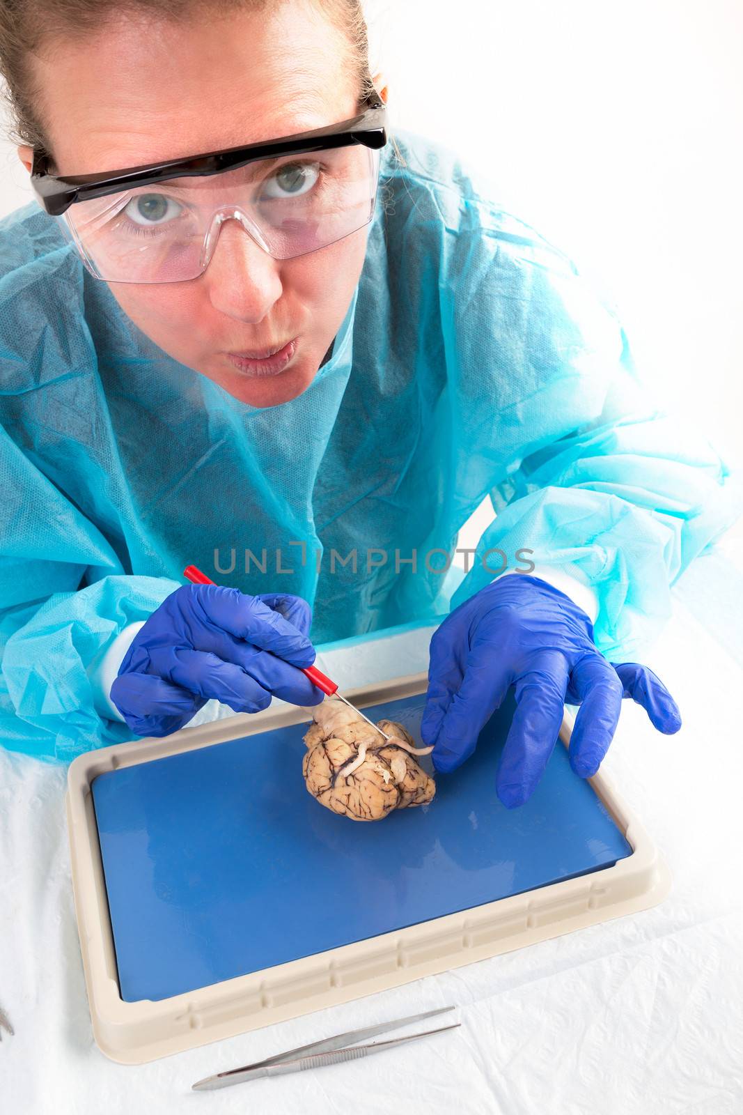 Student accidentally cuts the optic nerves of a cow Brain probably cow will go blind