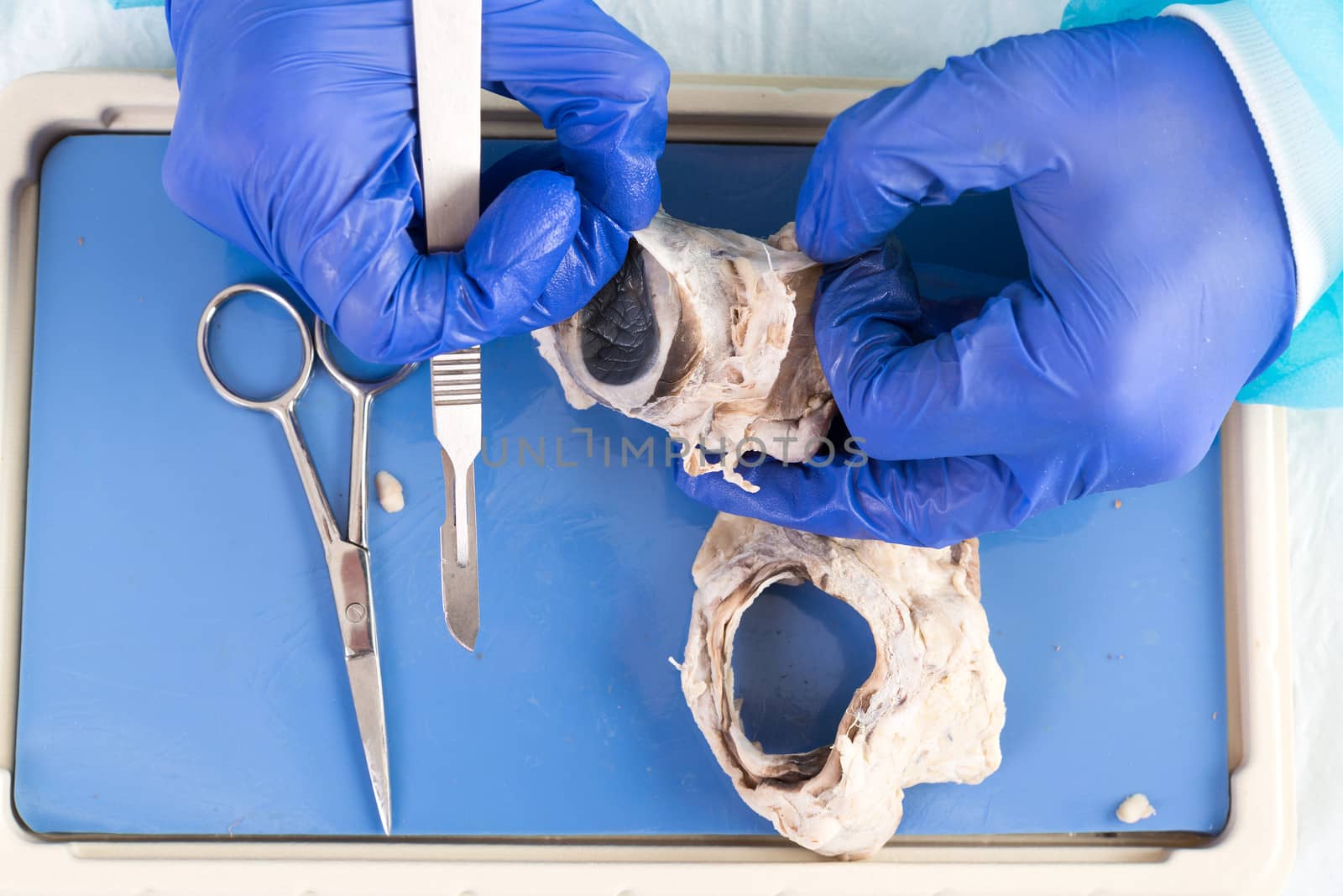 Close up of the gloved hands of a physiology student dissecting a sheep eye with a scalpel holding the eyeball in her hand