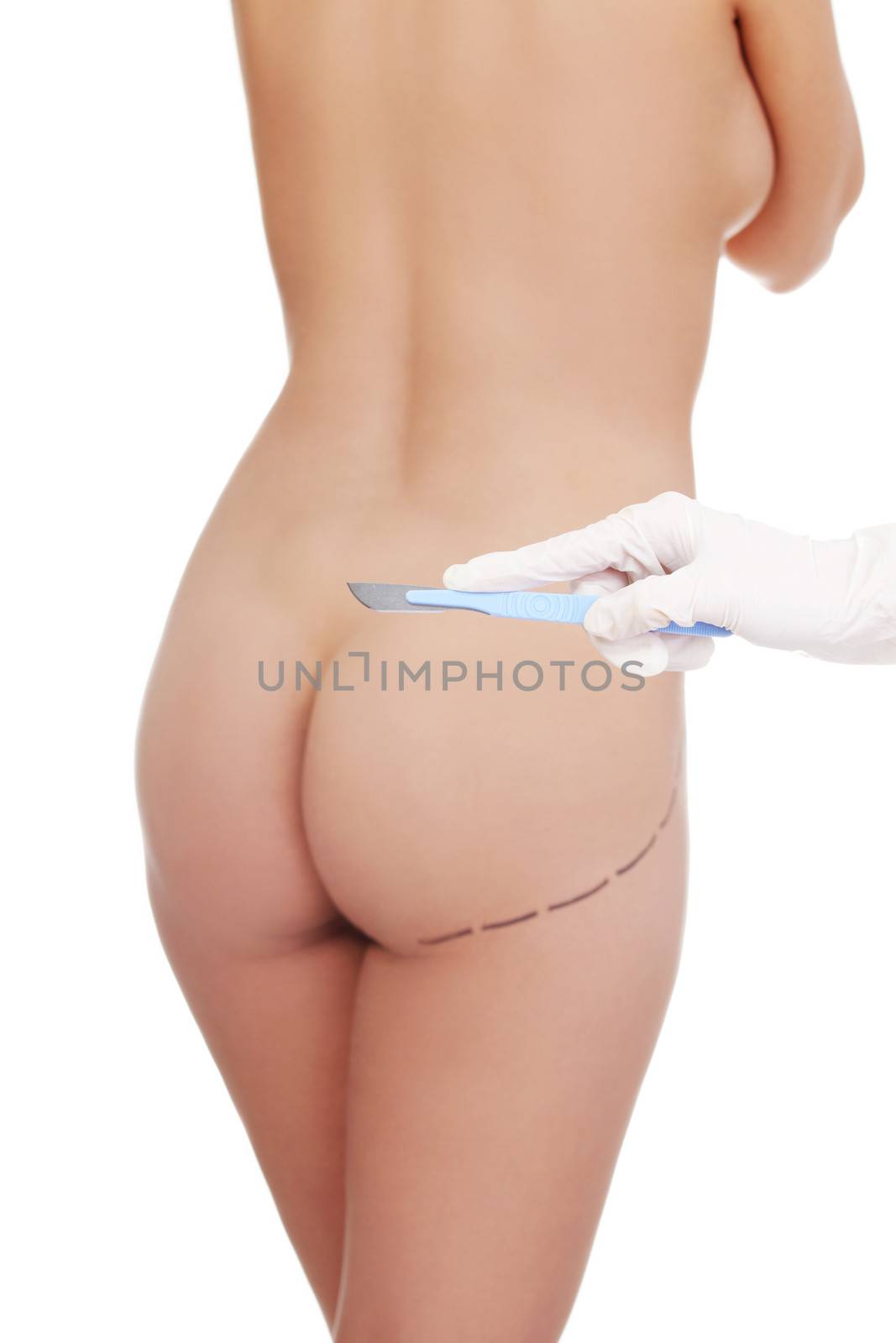 Surgeon hand in glove holding scalpel, against buttocks with cosmetic surgery lines