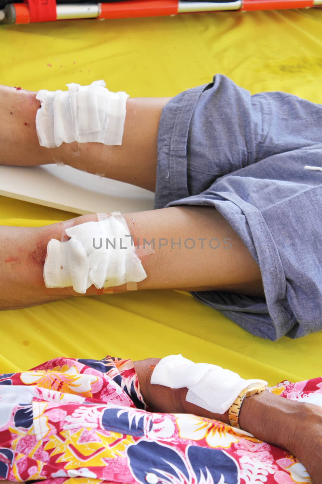 First aid by use gauze arrange cover on wound of leg